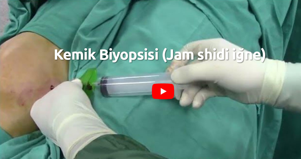 Video: Kemik Biyopsisi (Jam shidi iğne)